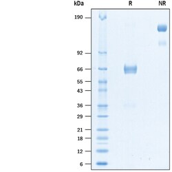 R D Systems Recombinant Human VSIG3 Fc Chimera Biotinylated Protein 50 &mu;g | Buy Online | R&amp;D Systems&trade; | Fisher Scientific