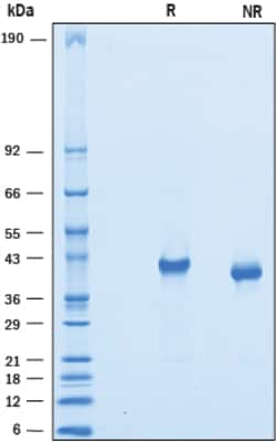 R&D Systems&trade;&nbsp;Recombinant Mouse VSTM2A His-tag Protein