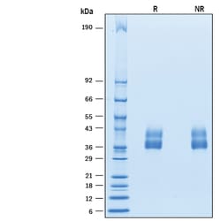 R&D Systems&trade;&nbsp;Recombinant Mouse VSTM4 His-tag Protein