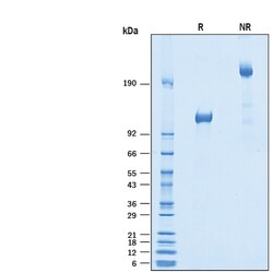 R D Systems Recombinant Human Vasorin/SLIT-like 2 Fc Chimera Protein 50 &mu;g | Buy Online | R&amp;D Systems&trade; | Fisher Scientific