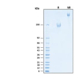 R D Systems Recombinant Human MUC-1 Fc Chimera Alexa Fluor 488 Protein 20 &mu;g | Buy Online | R&amp;D Systems&trade; | Fisher Scientific