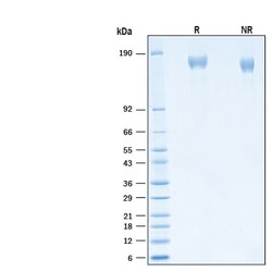 R D Systems Recombinant SARS-CoV-2 S GCN4-IZ Alexa Fluor 488 Protein 20 &mu;g | Buy Online | R&amp;D Systems&trade; | Fisher Scientific