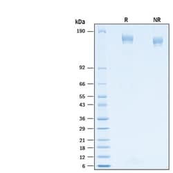 R&D Systems&trade;&nbsp;Recombinant SARS-CoV-2 P.1 Spike Alexa Fluor&trade; 488 Protein