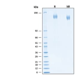 R D Systems Recombinant SARS-CoV-2 B.1.617.2 S Alexa Fluor 488 Protein 20 &mu;g | Buy Online | R&amp;D Systems&trade; | Fisher Scientific