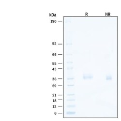 R D Systems Recombinant SARSCoV-2 B.1.1.529 RBD Alexa Fluor 488 Protein 20 &mu;g | Buy Online | R&amp;D Systems&trade; | Fisher Scientific