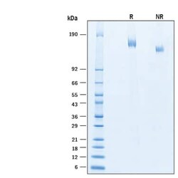 R D Systems Recombinant SARS-CoV-2 BA.2 S His Alexa Fluor 488 Protein 20 &mu;g | Buy Online | R&amp;D Systems&trade; | Fisher Scientific