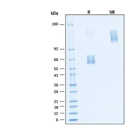 R D Systems Recombinant Human HVEM/TNFRSF14 Fc Alexa Fluor 488 Protein 20 &mu;g | Buy Online | R&amp;D Systems&trade; | Fisher Scientific