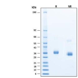 R D Systems Recombinant SARS-CoV2 BA.4/BA.5 RBD Alexa Fluor 488 Protein 20 &mu;g | Buy Online | R&amp;D Systems&trade; | Fisher Scientific