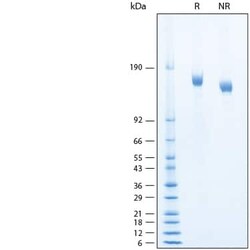 R D Systems Recombinant SARS-CoV-2 BA.4/BA.5 S Alexa Fluor 488 Protein 20 &mu;g | Buy Online | R&amp;D Systems&trade; | Fisher Scientific