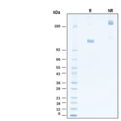 R D Systems Recombinant Human ErbB2/Her2 Fc His Alexa Fluor 488 Protein 20 &mu;g | Buy Online | R&amp;D Systems&trade; | Fisher Scientific