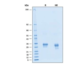 R D Systems Recombinant Human Fc gamma RIIA His Alexa Fluor 488 Protein 20 &mu;g | Buy Online | R&amp;D Systems&trade; | Fisher Scientific