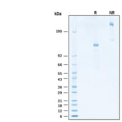 R&D Systems&trade;&nbsp;Recombinant Human Siglec-2/CD22 Fc Alexa Fluor&trade; 488 Protein
