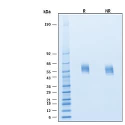 R D Systems Recombinant Human SIRP alpha His Alexa Fluor 488 Protein 20 &mu;g | Buy Online | R&amp;D Systems&trade; | Fisher Scientific