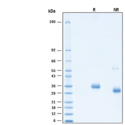 R D Systems Recombinant SARS-CoV-2 Spike RBD Alexa Fluor 647 Protein 20 &mu;g | Buy Online | R&amp;D Systems&trade; | Fisher Scientific