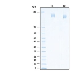 R D Systems Recombinant SARS-CoV-2 S GCN4-IZ Alexa Fluor 647 Protein 20 &mu;g | Buy Online | R&amp;D Systems&trade; | Fisher Scientific
