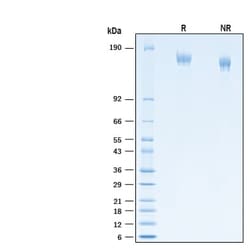 R D Systems Recombinant SARS-CoV-2 P.1 Spike Alexa Fluor 647 Protein 20 &mu;g | Buy Online | R&amp;D Systems&trade; | Fisher Scientific