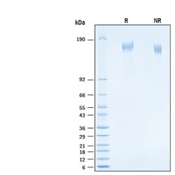 R D Systems Recombinant SARS-CoV-2 S GCN4-IZ Alexa Fluor 647 Protein 20 &mu;g | Buy Online | R&amp;D Systems&trade; | Fisher Scientific