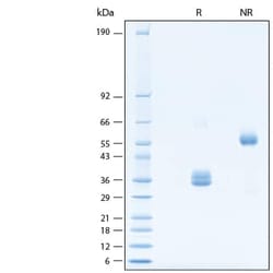 R D Systems Recombinant Human IgG1 Fc Chimera Alexa Fluor 647 Protein 20 &mu;g | Buy Online | R&amp;D Systems&trade; | Fisher Scientific