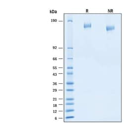 R D Systems Recombinant SARS-CoV-2 BA.2 S His Alexa Fluor 647 Protein 20 &mu;g | Buy Online | R&amp;D Systems&trade; | Fisher Scientific