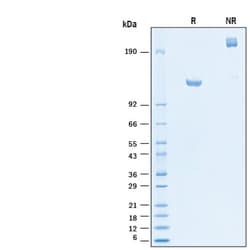 R D Systems Recombinant Human ErbB2/Her2 Fc His Alexa Fluor 647 Protein 20 &mu;g | Buy Online | R&amp;D Systems&trade; | Fisher Scientific