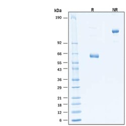 R D Systems Recombinant Human CD40/TNFRSF5 Fc Alexa Fluor 647 Protein 20 &mu;g | Buy Online | R&amp;D Systems&trade; | Fisher Scientific