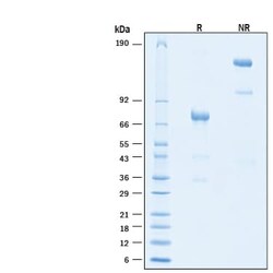 R D Systems Recombinant Human PD-L1/B7-H1 Fc Alexa Fluor 647 Protein 20 &mu;g | Buy Online | R&amp;D Systems&trade; | Fisher Scientific
