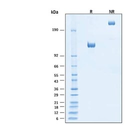 R D Systems Recombinant Human EGFR Fc Chimera Alexa Fluor 647 Protein 20 &mu;g | Buy Online | R&amp;D Systems&trade; | Fisher Scientific