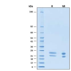 R D Systems Recombinant Human GITR Ligand Alexa Fluor 647 Protein 20 &mu;g | Buy Online | R&amp;D Systems&trade; | Fisher Scientific