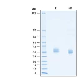 R D Systems Recombinant Human PD-L1/B7-H1 His Alexa Fluor 647 Protein 20 &mu;g | Buy Online | R&amp;D Systems&trade; | Fisher Scientific