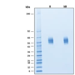 R D Systems Recombinant Human SIRP alpha His Alexa Fluor 647 Protein 20 &mu;g | Buy Online | R&amp;D Systems&trade; | Fisher Scientific