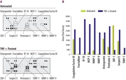 R&D Systems™ Proteome Profiler Mouse Angiogenesis Array Kit