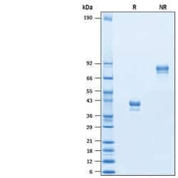 R&D Systems&trade;&nbsp;Recombinant Human BCMA/TNFRSF17 Protein, Atto 647N Conjugate