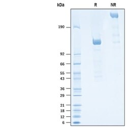 R D Systems Recombinant Human Siglec-2/CD22 Protein, Atto 647N Conjugate 50 &mu;g | Buy Online | R&amp;D Systems&trade; | Fisher Scientific