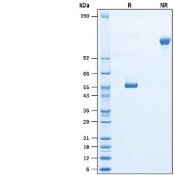 R&D Systems&trade;&nbsp;Biotinylated Recombinant Human LAIR2 Fc Avi-tag Protein