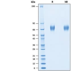 R&D Systems&trade;&nbsp;Recombinant Human IL-6R alpha His-tag Avi-tag Protein