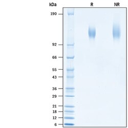 R D Systems Recombinant SARS-CoV-2 Spike S1 Subunit His Avi Protein 50 &mu;g | Buy Online | R&amp;D Systems&trade; | Fisher Scientific