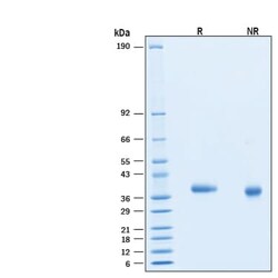 R&D Systems&trade;&nbsp;Recombinant SARS-CoV-2 P.1 S RBD His-tag Avi-tag Protein