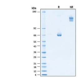 R&D Systems&trade;&nbsp;Recombinant Human IL-2 R beta Fc Chimera Avi-tag Protein