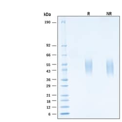 R&D Systems&trade;&nbsp;Recombinant Human IFN-gamma R1/CD119 Avi-tag His Protein