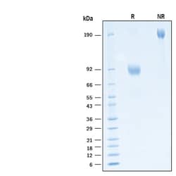 R D Systems Recombinant Human Common gamma Chain Fc Avi Protein 50 &mu;g | Buy Online | R&amp;D Systems&trade; | Fisher Scientific