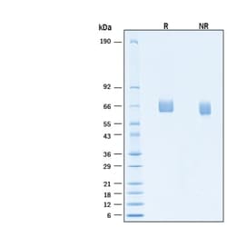R&D Systems&trade;&nbsp;Recombinant Human FGFR3 (IIIb) His-tag Avi-tag Protein
