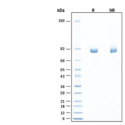 R D Systems Recombinant Human alpha-L-Iduronidase/IDUA Avi Protein, CF 10 &mu;g | Buy Online | R&amp;D Systems&trade; | Fisher Scientific