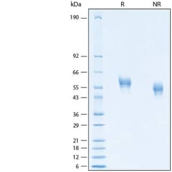 R D Systems Recombinant Human IL-18 R beta/IL-1 R7 His Avi Protein 50 &mu;g | Buy Online | R&amp;D Systems&trade; | Fisher Scientific