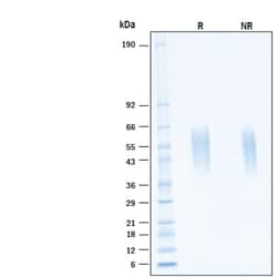 R DSystems Recombinant Human Fc gamma RIIIB/CD16b His Avi Protein, CF 50 &mu;g | Buy Online | R&amp;DSystems&trade; | Fisher Scientific