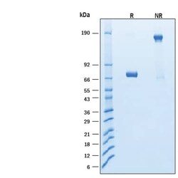 R D Systems Recombinant Human IFN-gamma R2 Fc Chimera Avi Protein, CF 50 &mu;g | Buy Online | R&amp;D Systems&trade; | Fisher Scientific