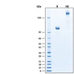 R D Systems Recombinant Human alpha-L-Iduronidase/IDUA Avi Protein, CF 10 &mu;g | Buy Online | R&amp;D Systems&trade; | Fisher Scientific