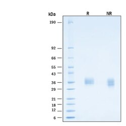 R&D Systems&trade;&nbsp;Recombinant Human Fc gamma RIIA/CD32a Avi His Protein
