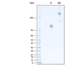 R&D Systems&trade;&nbsp;Recombinant Human Osteoactivin/GPNMB Fc Avi-tag Protein