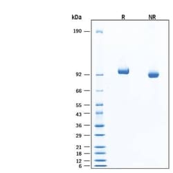 R D Systems Recombinant Human MMP-9 His-tag Avi-tag Protein, CF 20 &mu;g | Buy Online | R&amp;D Systems&trade; | Fisher Scientific