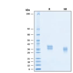 R&D Systems&trade;&nbsp;Recombinant Human 4-1BB/TNFRSF9 His Avi-tag Protein